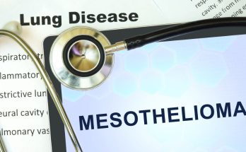 08. mesothelioma attorney assistance photo and picture